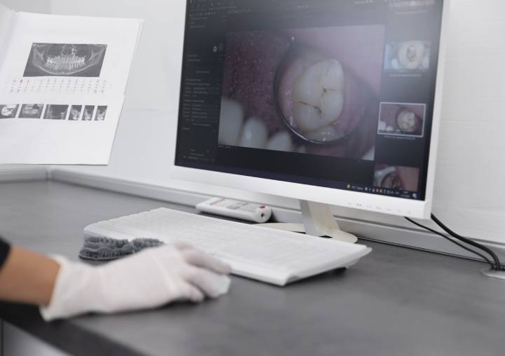 The Use of 3D Printing Technology in Dental Treatment