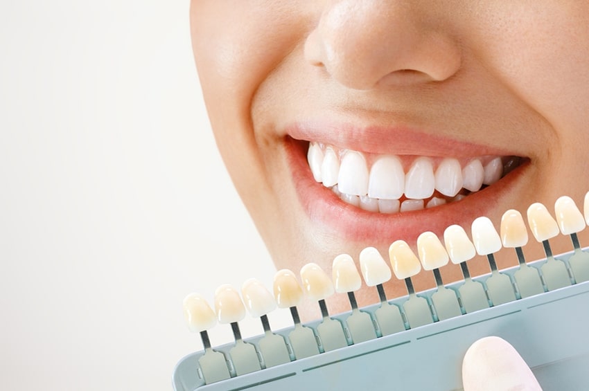 Interesting Methods to Whiten Your Teeth